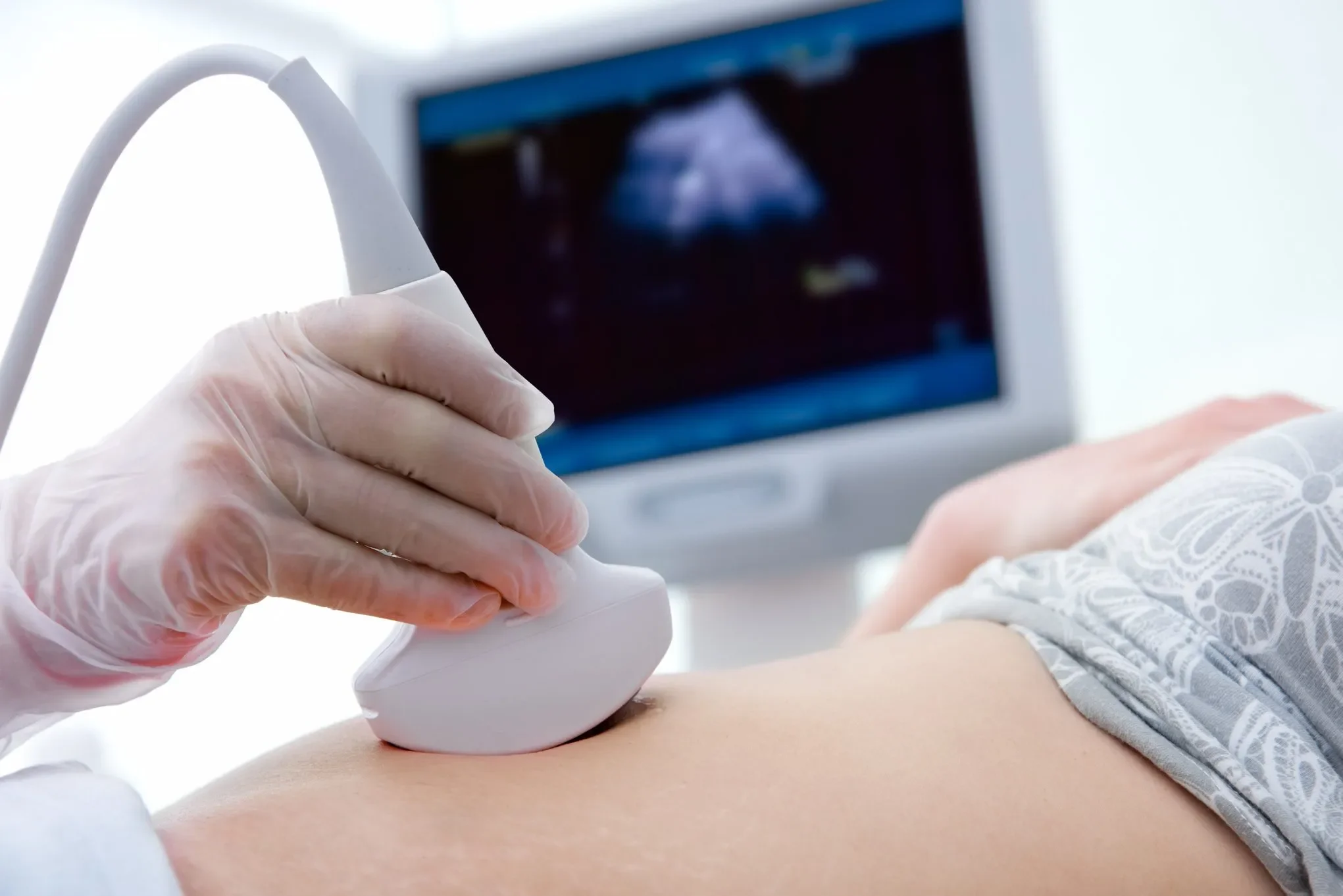 Médico realiza ultrassonografia em gestante com monitor ao fundo exibindo imagem do feto